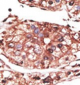 NOTCH1 Antibody (C-term)
